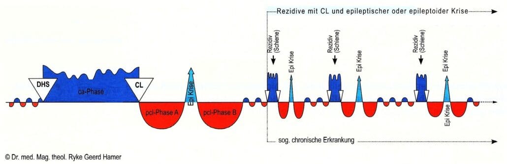126 Typ A der sogenannten „chronischen Krankheiten“ mit komplettem SBS