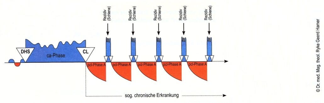 127 Typ B der „chronischen Krankheiten“ ohne komplette SBS