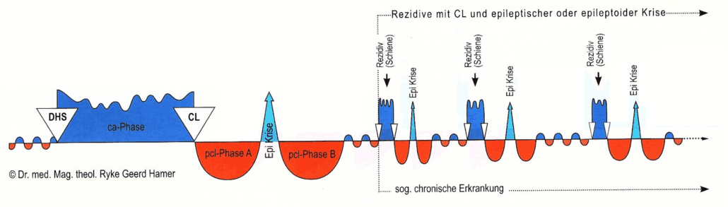 131 Chronisch-rezidivierende Konflikte der sogenannten „chronischen Krankheiten“ mit komplettem SBS ohne Mein Studentenmaedchen